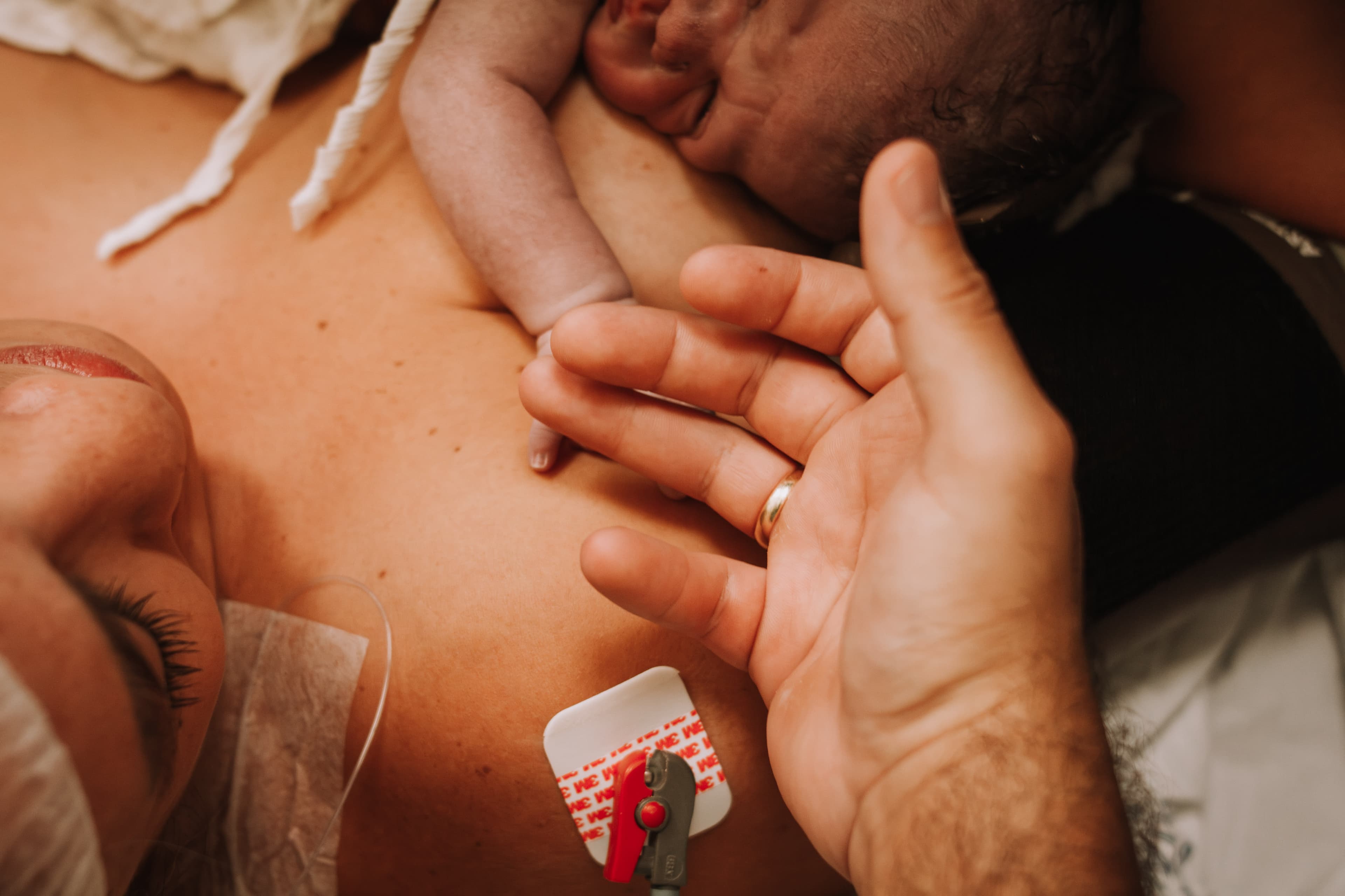 Imagem de capa do post A pergunta que não quer calar: O valor do acompanhamento em cesáreas é diferente do parto normal?